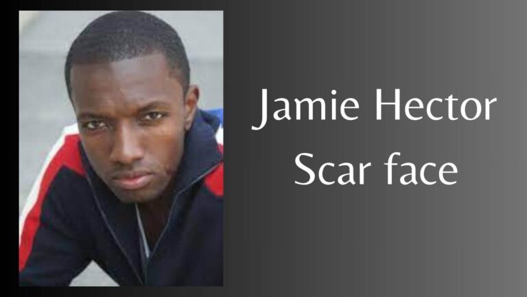 Jamie Hector Scar face